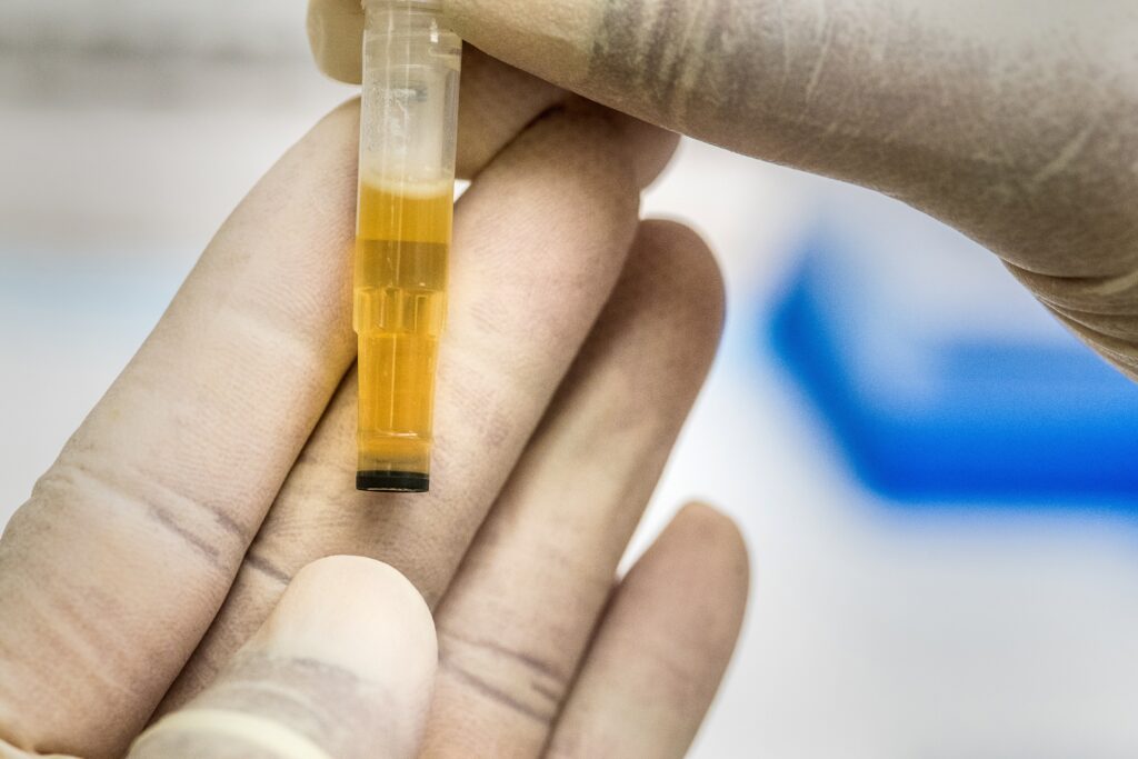 24-hour urinalysis for digestive health screening